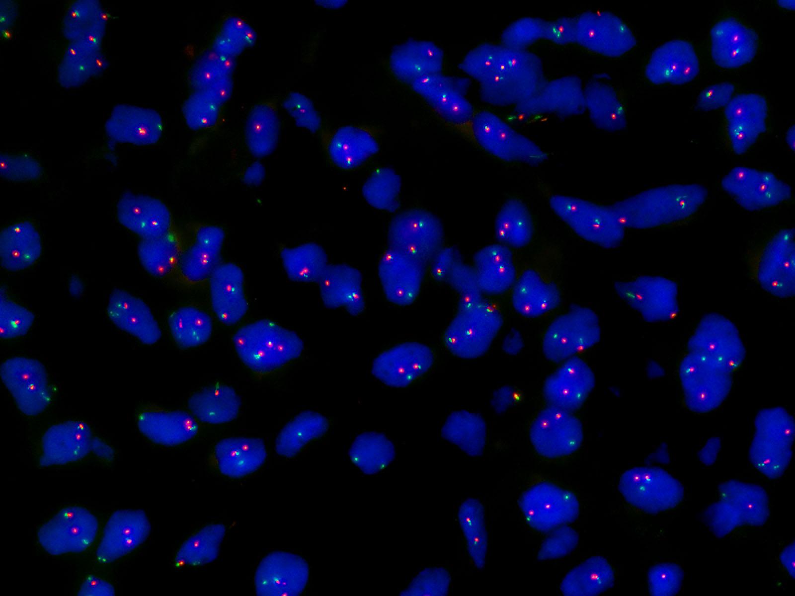 FP-052-b-DDIT3ć–裂